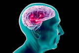 Cannabis : découverte d&rsquo;un nouvel effet bénéfique pour les cellules du cerveau qui pourrait aider à traiter la maladie d&rsquo;Alzheimer
